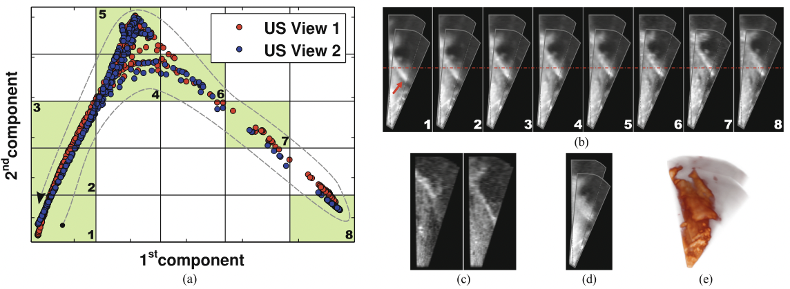Self-Aligning Manifolds for Matching Disparate Medical Image Datasets